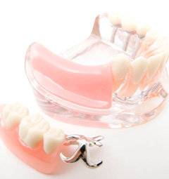 入れ歯（義歯）治療