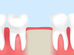 正常な歯